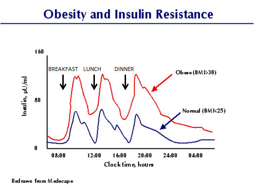 Insulin Resistance - Baby Boomers Health Center
