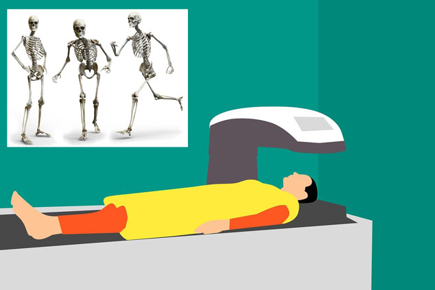 bone health and DEXA